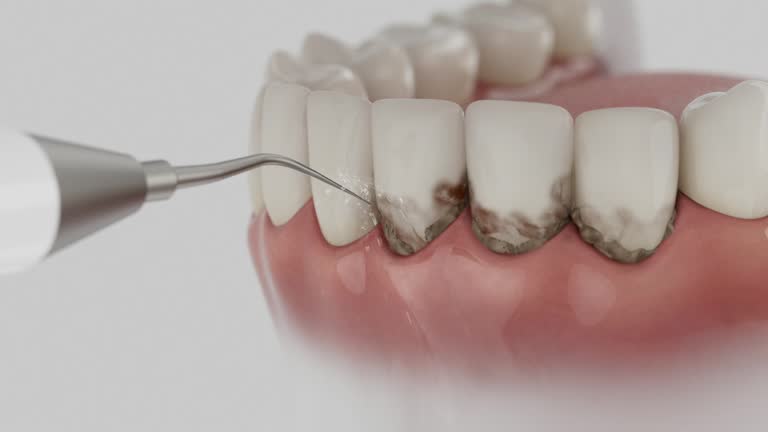 Trusted Tooth Extraction service in Fort Bliss, TX - Dentist Open Now